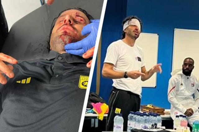 九游体育官网-格罗索遇袭受伤，法甲“意大利德比”被迫延期